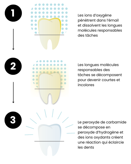 fonctionnement-ions-blanchissement-dents