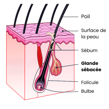 schéma-glande-sebacee-aviclear-acne