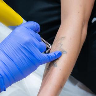 Peut-on mettre de la vaseline sur un tatouage ?